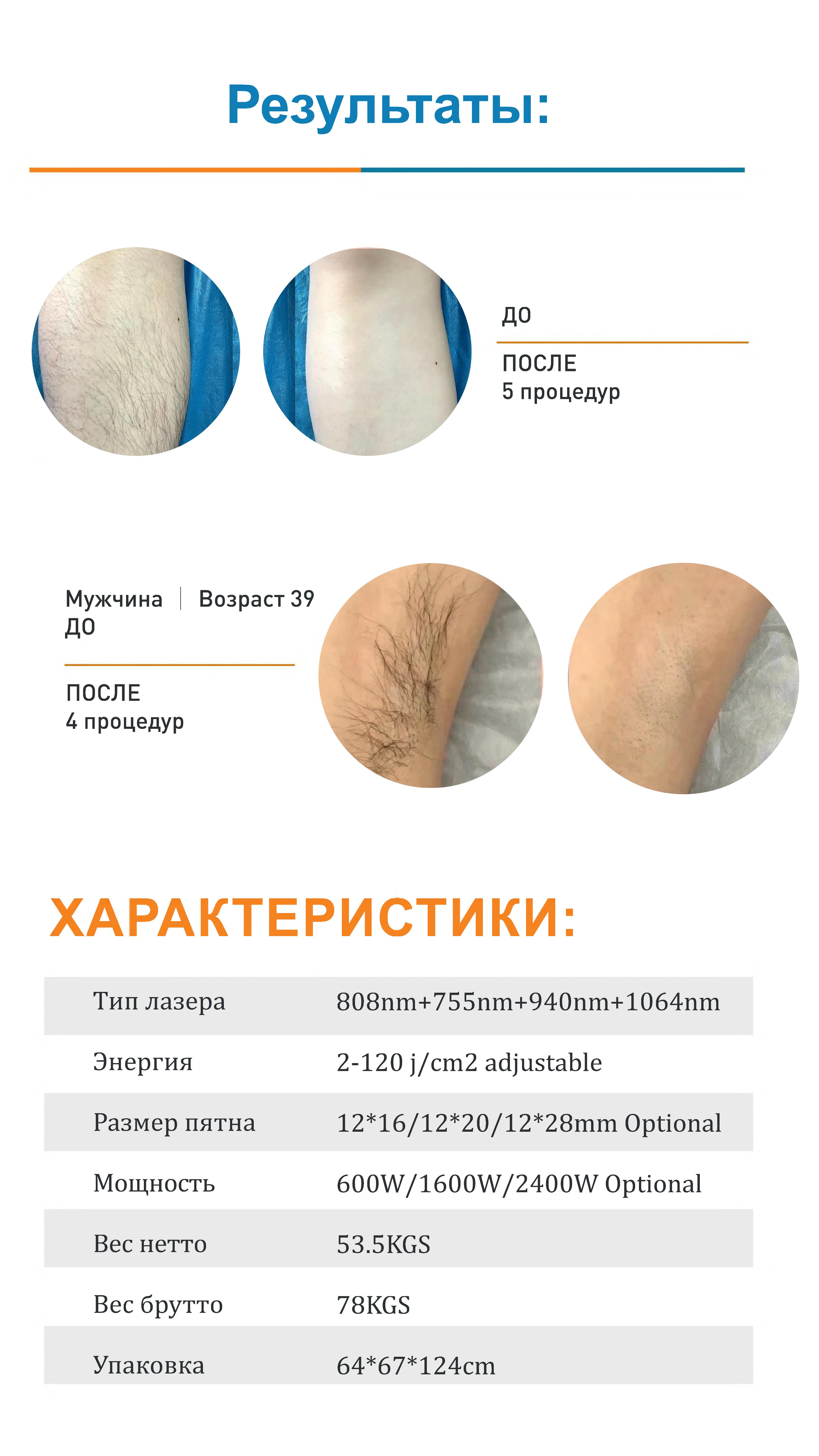 Технические характеристики лазера